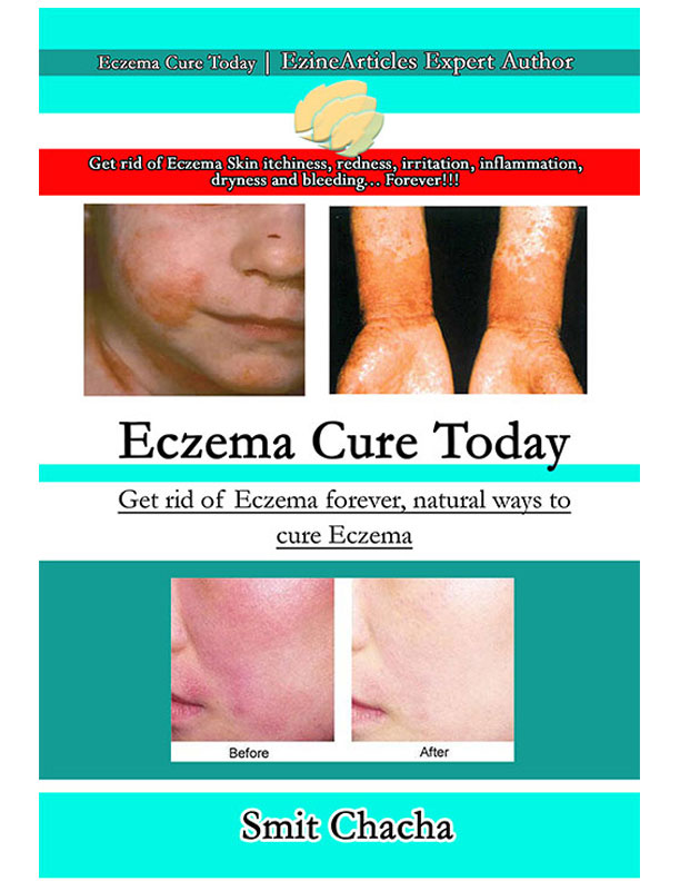 Eczema Cure Today Book