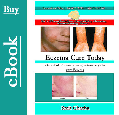 Buy Eczema Cure Today eBook (digital)