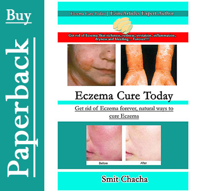 Buy Eczema Cure Today Paperback Book
